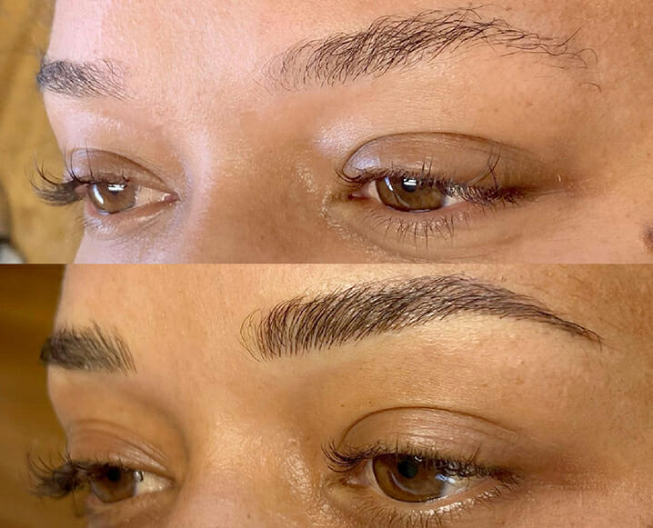 brow treatments before and after